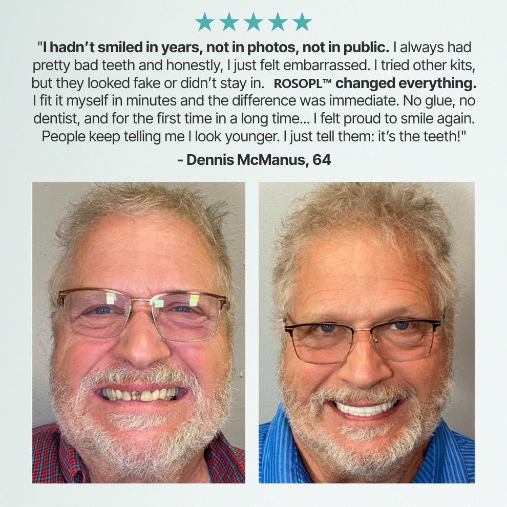 🔥Ends Today: 70% OFF!🦷DarkFairy™ Custom-Fit Full Functional Dentures Make you more confident
