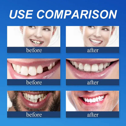 Ends Today: 70% OFF! ⏰DarkFairy™ Medical Full Denture with Strong Suctiond🦷Obtain American Dental Association (ADA) Certification