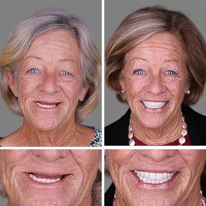 Ends Today: 70% OFF! ⏰DarkFairy™ Medical Full Denture with Strong Suctiond🦷Obtain American Dental Association (ADA) Certification
