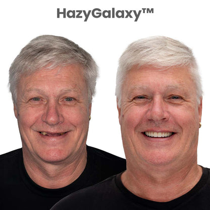 --🦷 HazyGalaxy™ Custom-Fit Dentures ⏰ ENDS TODAY   70% OFF | Smile with Confidence