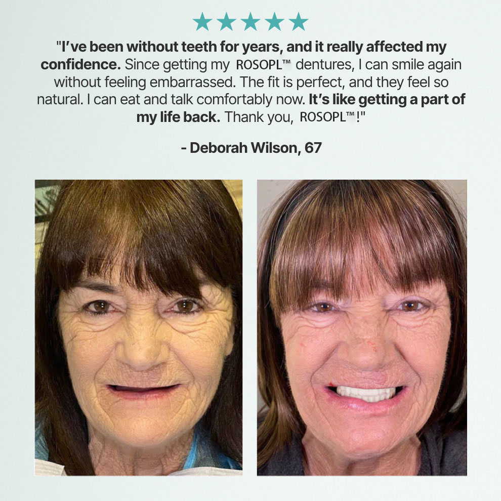 🔥Ends Today: 70% OFF!🦷DarkFairy™ Custom-Fit Full Functional Dentures Make you more confident