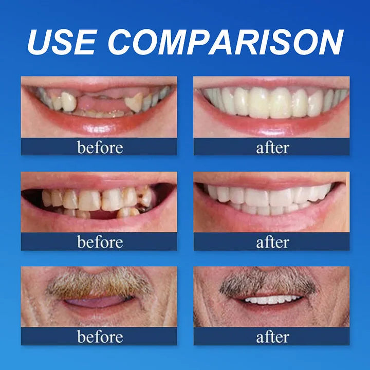 Ends Today: 70% OFF! ⏰DarkFairy™ Medical Full Denture with Strong Suctiond🦷Obtain American Dental Association (ADA) Certification